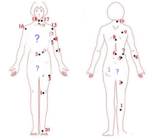 女人身体有痣图解析位置，女身上痣的位置命运图